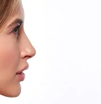 Le nez grec : une analyse approfondie de ses caractéristiques esthétiques et de son impact sur la perception du profil nasal