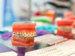 Pourquoi faire appel à une orthodontie low cost ?