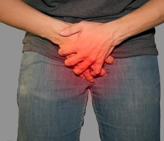 Comment repérer et traiter les symptômes de la gonorrhée chez les femmes