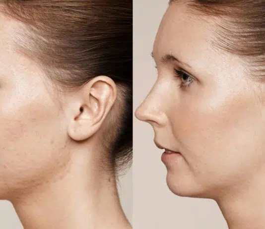 Peelings du visage : en quoi consiste-t-il ?